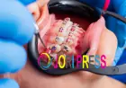 Monticello Braces: What Should You Know Before Starting Treatment?