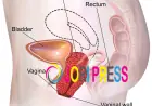 Ayurvedic Care for Prolapsed Uterus