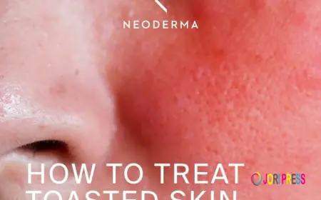 Heat Rash on Face: Causes, Symptoms, Treatment, and Prevention