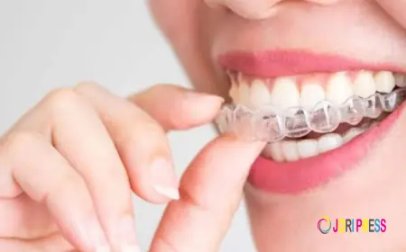 Elegant Smiles Offers SimplyClear Aligners in Atlanta for a Discreet Approach to Teeth Straightening