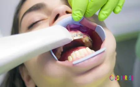 Maple Lake Braces: What Should You Know Before Choosing Braces?