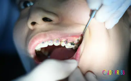 Cokato Braces: What to Know Before Starting Orthodontic Treatment