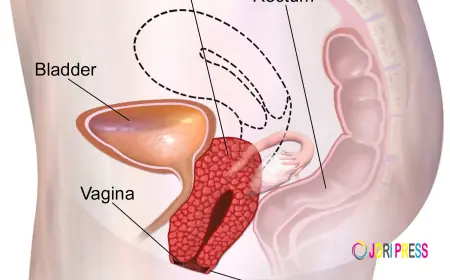 Ayurvedic Care for Prolapsed Uterus