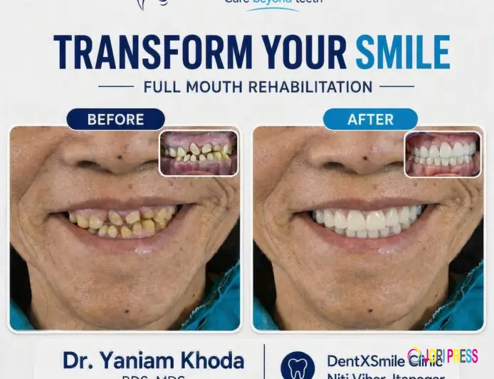 Looking for "Dental Implants Near Me"? Here's Everything You Need to Know Before You Choose