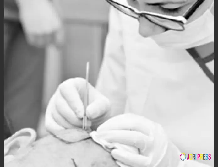 Want Hair Ltd Highlights Personalised Planning in Sapphire FUE Hair Transplant Turkey