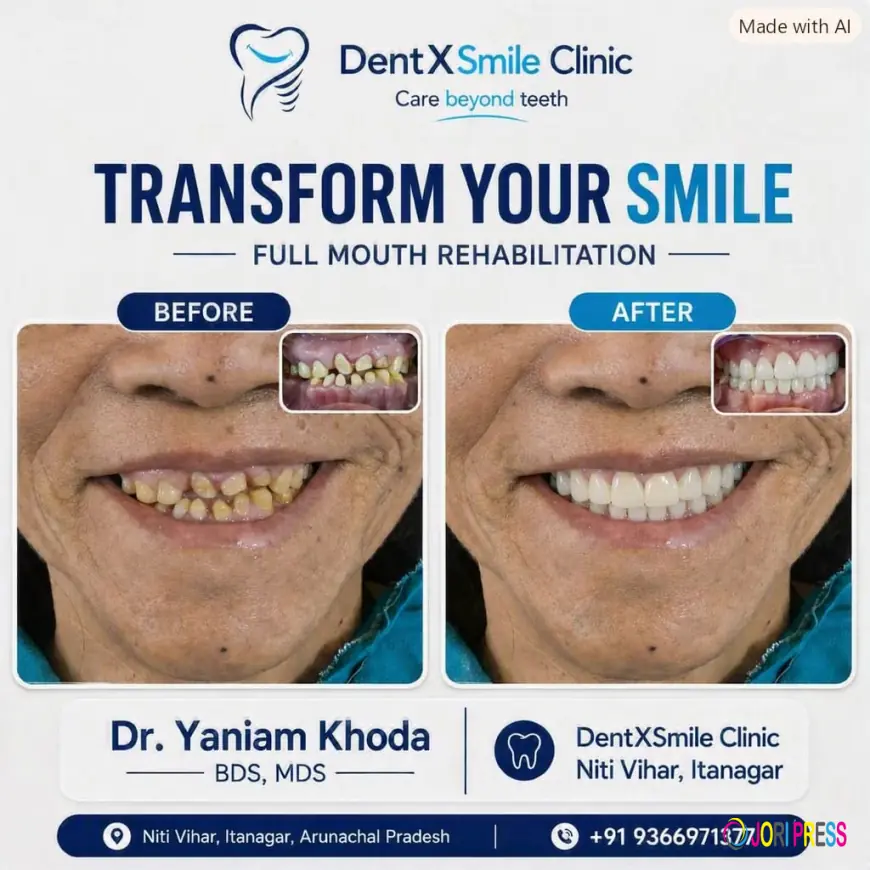 Looking for "Dental Implants Near Me"? Here's Everything You Need to Know Before You Choose