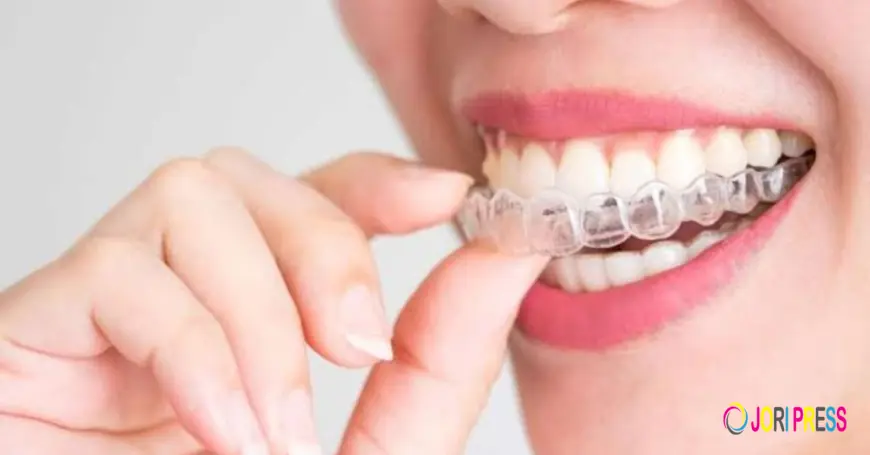 Elegant Smiles Offers SimplyClear Aligners in Atlanta for a Discreet Approach to Teeth Straightening