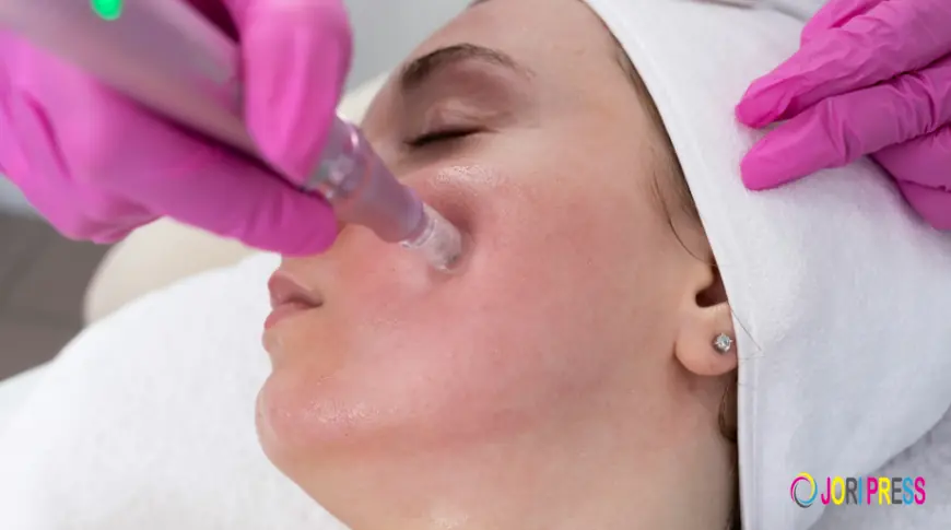 Professional Microneedling Treatment in Portland at The Facial Room LLC
