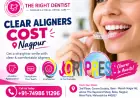 Clear Aligners Cost in Nagpur