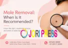 Mole Removal: When Is It Recommended?
