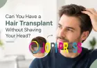 Can You Have a Hair Transplant Without Shaving Your Head?