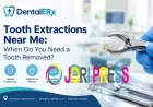 Tooth Extractions near Me: When Do You Need a Tooth Removed?