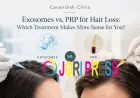 Exosomes vs. PRP for Hair Loss: Which Treatment Makes More Sense for You?