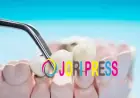 How to Care for a Dental Crown: Daily Habits That Work