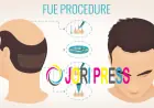 Want Hair Ltd Welcomes New Specialist Team to Lead FUE Hair Replacement Treatments