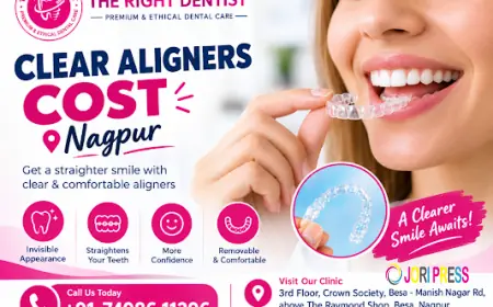 Clear Aligners Cost in Nagpur