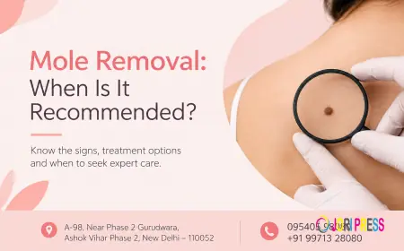 Mole Removal: When Is It Recommended?