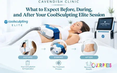 What to Expect Before, During, and After Your CoolSculpting Elite Session