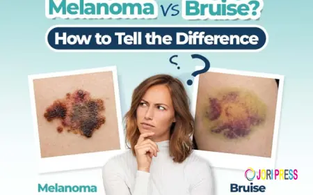 Nail Bruise or Subungual Melanoma? Key Differences