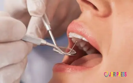 Invisalign Kellyville Ridge NSW: How Can You Achieve a Straighter Smile Confidently?