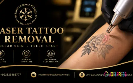 How Can Tattoo Removal Help Refresh Skin?