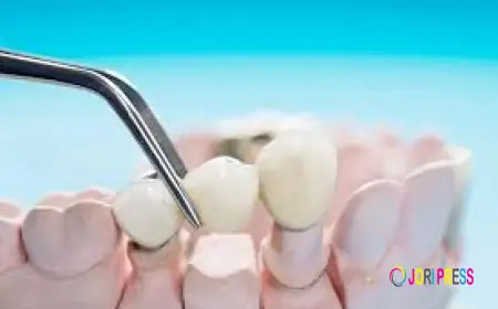 How to Care for a Dental Crown: Daily Habits That Work