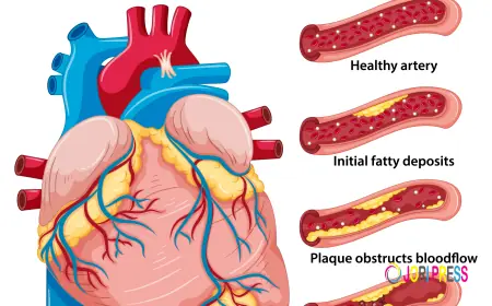 Angioplasty in Heart: The Recovery Questions Patients Are Afraid to Ask