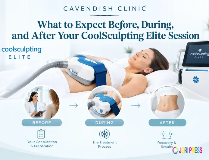 What to Expect Before, During, and After Your CoolSculpting Elite Session