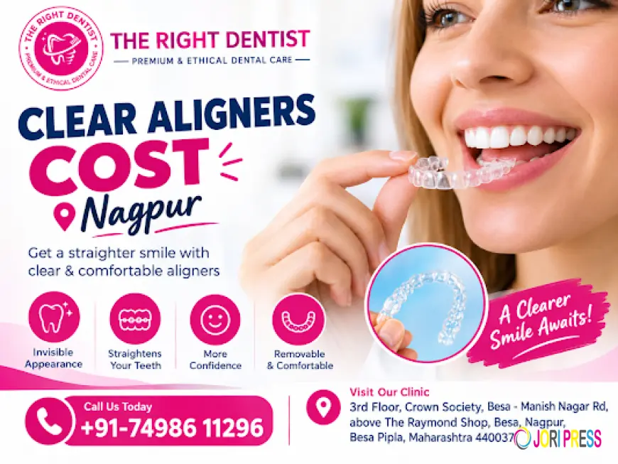 Clear Aligners Cost in Nagpur