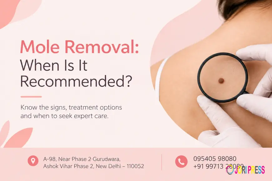 Mole Removal: When Is It Recommended?