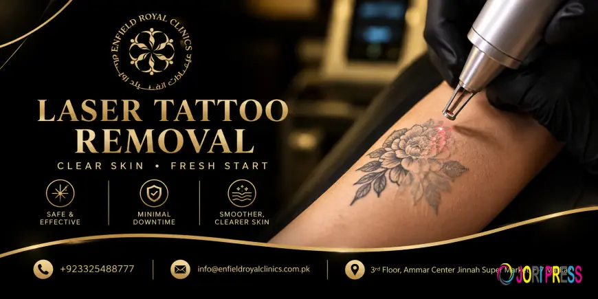 How Can Tattoo Removal Help Refresh Skin?
