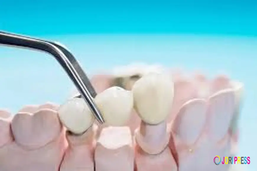How to Care for a Dental Crown: Daily Habits That Work