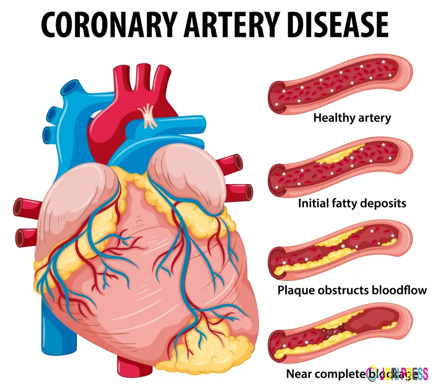Angioplasty in Heart: The Recovery Questions Patients Are Afraid to Ask