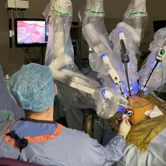 Trans Oral Robotic Surgery in India