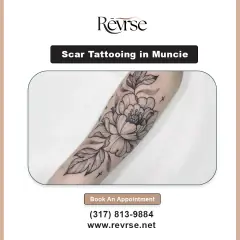 revrse